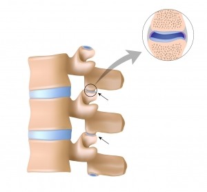 Facet joints Facet joints